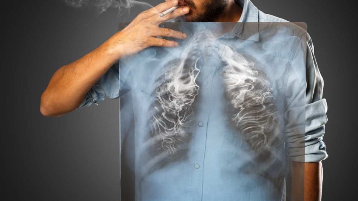 سیگار و بیماری‌های ریه؛ از COPD تا سرطان